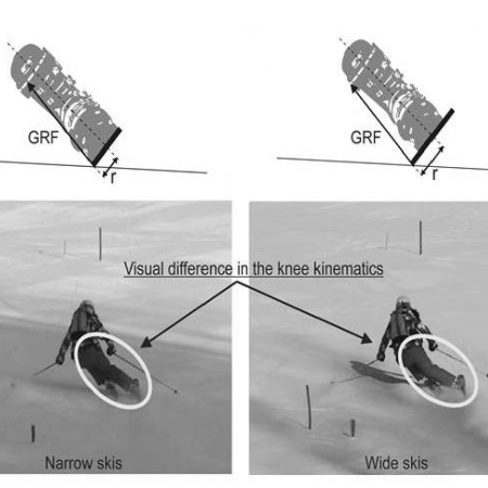 The Waist Width of Skis Influences the Kinematics of the Knee Joint in Alpine Skiing.
